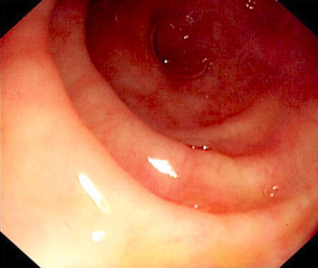 com.bmj.content.model.assessment.Caption@72248d5e