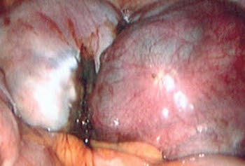 com.bmj.content.model.assessment.Caption@20d9fd91