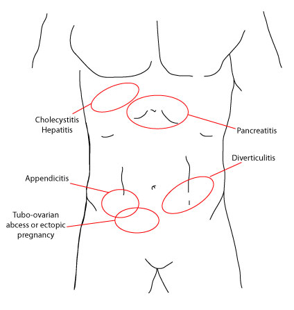 com.bmj.content.model.assessment.Caption@2321eaa