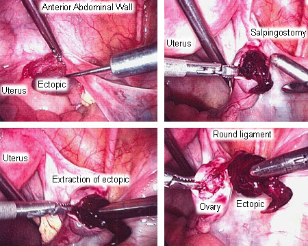 com.bmj.content.model.assessment.Caption@1bddefc2