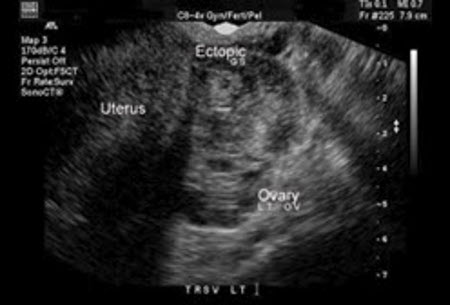 com.bmj.content.model.assessment.Caption@45ac284d
