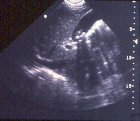 com.bmj.content.model.assessment.Caption@11c92a27