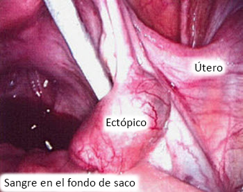com.bmj.content.model.assessment.Caption@51041053