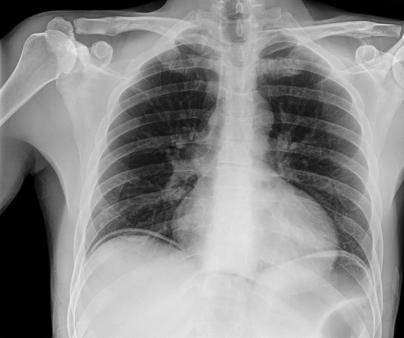 com.bmj.content.model.assessment.Caption@68a90f73