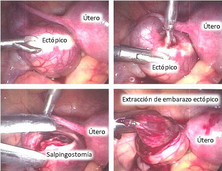 com.bmj.content.model.assessment.Caption@49f68c51