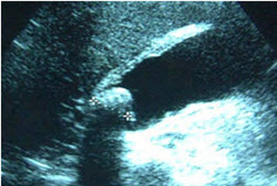 com.bmj.content.model.assessment.Caption@157b955b