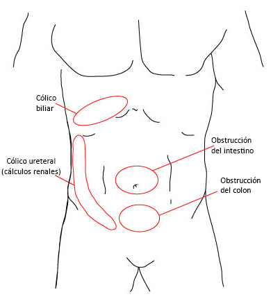 com.bmj.content.model.assessment.Caption@1527b326