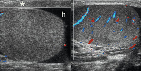 com.bmj.content.model.assessment.Caption@3829690c