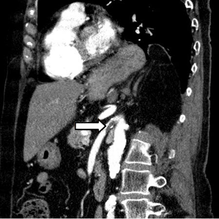 com.bmj.content.model.assessment.Caption@44f04887