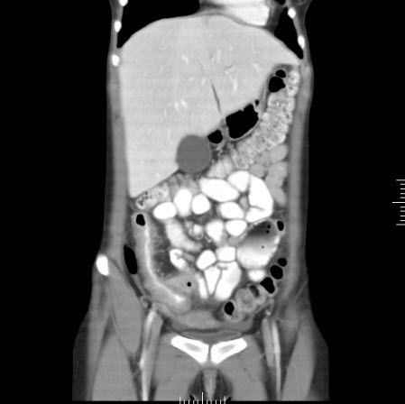 com.bmj.content.model.assessment.Caption@1a33b18