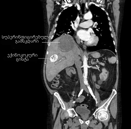 com.bmj.content.model.assessment.Caption@6fa80e5a
