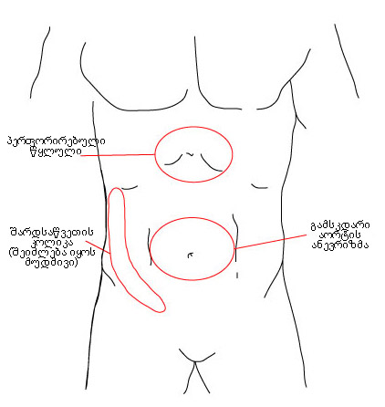 com.bmj.content.model.assessment.Caption@4125d5f3