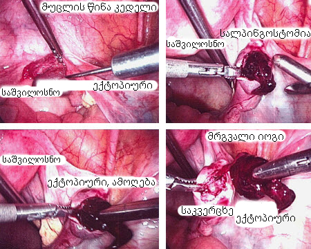com.bmj.content.model.assessment.Caption@34940fe6