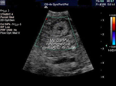 com.bmj.content.model.assessment.Caption@1b2f0d66