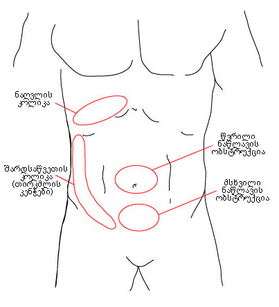 com.bmj.content.model.assessment.Caption@b108215