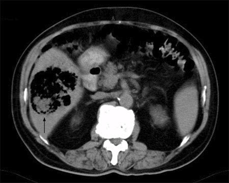 com.bmj.content.model.assessment.Caption@694ff07d