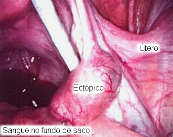 com.bmj.content.model.assessment.Caption@5bd092f2