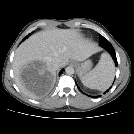 com.bmj.content.model.assessment.Caption@1c111c2b