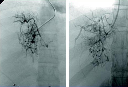 com.bmj.content.model.assessment.Caption@4d607801