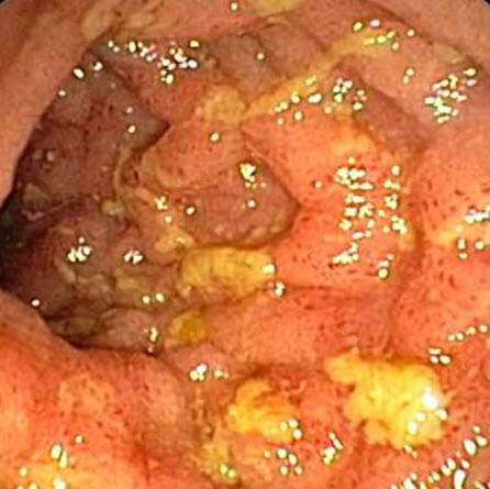 com.bmj.content.model.assessment.Caption@6613506a