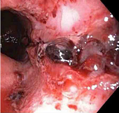 com.bmj.content.model.assessment.Caption@28a2b1bc