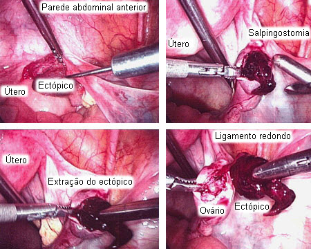 com.bmj.content.model.assessment.Caption@30cc115f