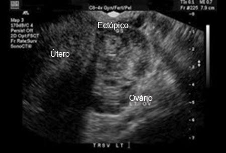 com.bmj.content.model.assessment.Caption@744505d4