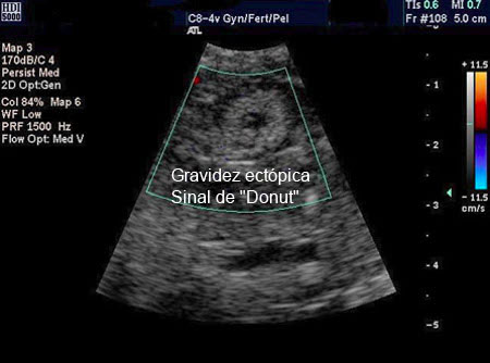 com.bmj.content.model.assessment.Caption@67b32c5b