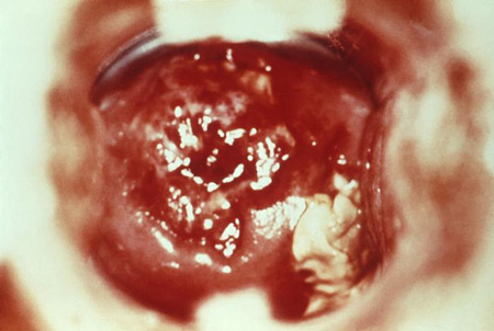 com.bmj.content.model.assessment.Caption@45996080