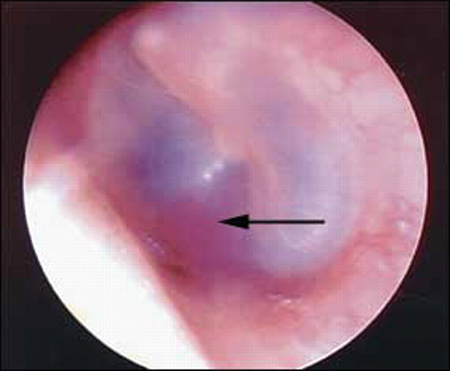 com.bmj.content.model.assessment.Caption@73b12724