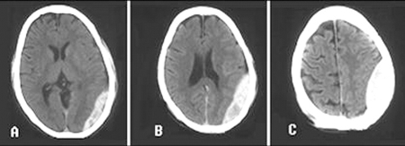 com.bmj.content.model.assessment.Caption@80f9467