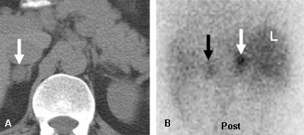 Assessment of incidental adrenal mass images