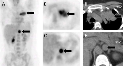 com.bmj.content.model.assessment.Caption@49710d52