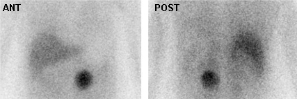 com.bmj.content.model.assessment.Caption@37d6547c