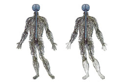 Neuropatia diabética images