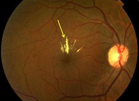 com.bmj.content.model.Caption@4b941ebd