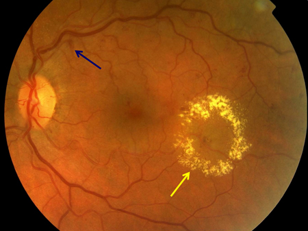 com.bmj.content.model.Caption@4e4c646c