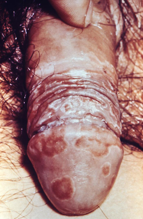 com.bmj.content.model.Caption@795ffdfe