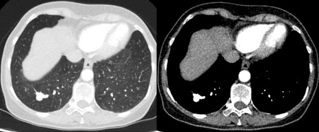 com.bmj.content.model.assessment.Caption@6c871715