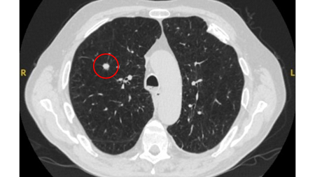 com.bmj.content.model.assessment.Caption@16003b63