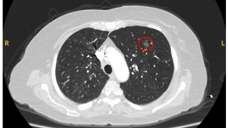 com.bmj.content.model.assessment.Caption@745c67bf
