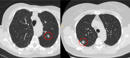 com.bmj.content.model.assessment.Caption@32ce32fe
