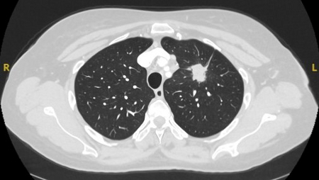 com.bmj.content.model.assessment.Caption@281f4804