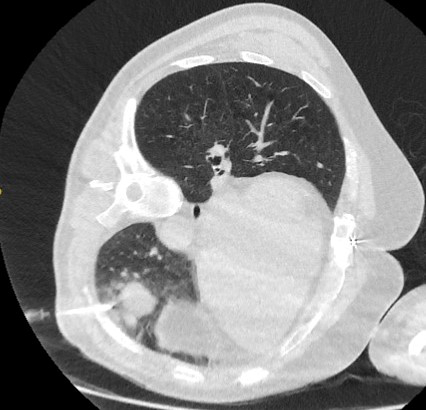 com.bmj.content.model.assessment.Caption@748069b