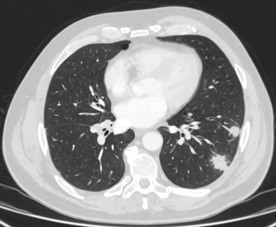 com.bmj.content.model.assessment.Caption@4f5f715a