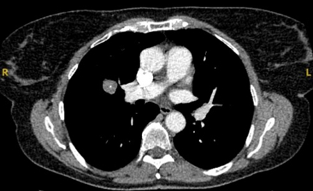 com.bmj.content.model.assessment.Caption@634042d7