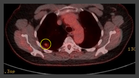 com.bmj.content.model.assessment.Caption@6427b407