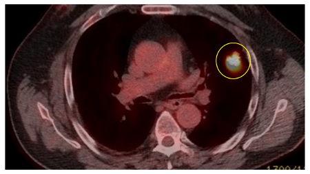 com.bmj.content.model.assessment.Caption@108fc37b