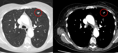 com.bmj.content.model.assessment.Caption@45f89f6d