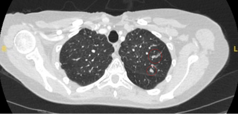 com.bmj.content.model.assessment.Caption@14b0e6df